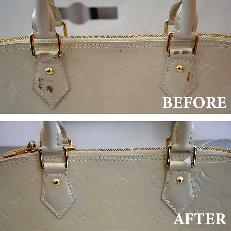 エナメル修復事例